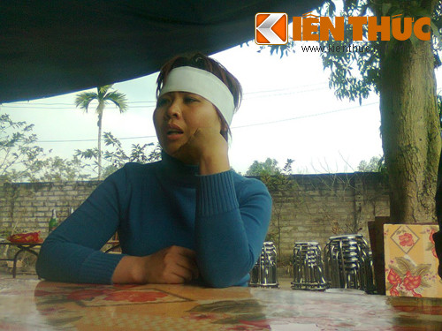 Thi the hon 20 vet dam: Bi an 2 thanh nien la-Hinh-3