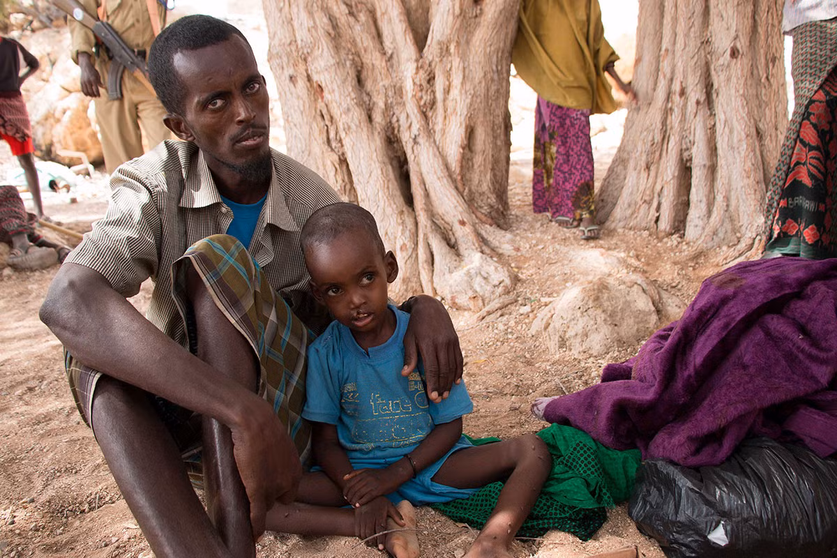 Ahmed Osman lặn lội đưa con trai, bé Mohamed, từ vùng Nugaal đến Dhudo để khám bệnh.