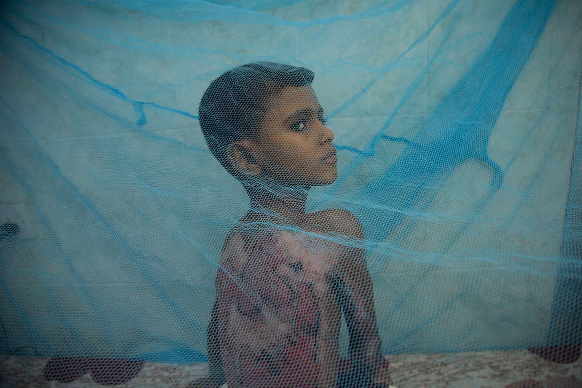 Một bé trai bị bỏng được điều trị tại bệnh viện ở Yemen. Được biết, hàng trăm trẻ nhỏ đã thiệt mạng trong các cuộc giao tranh tại đất nước này.