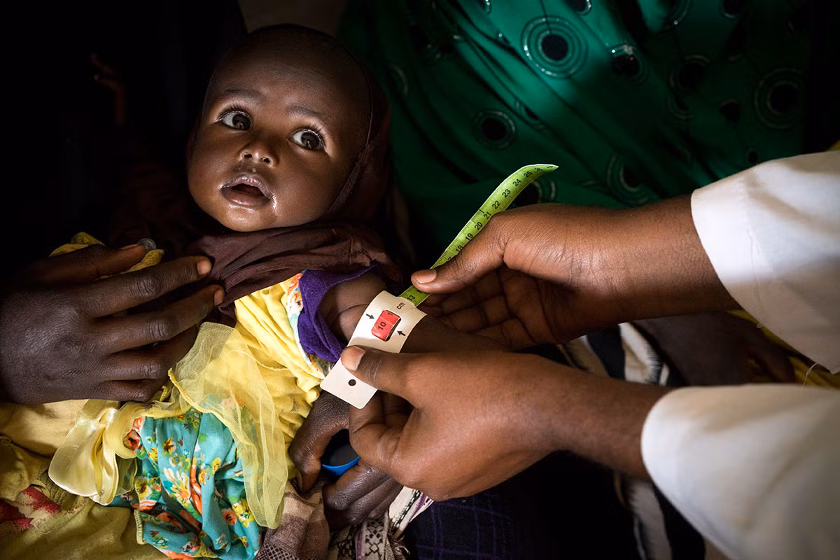 Hinh anh nan doi Somalia dang de doa 6,2 trieu nguoi-Hinh-11