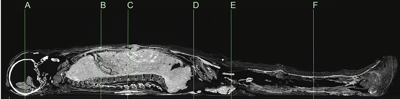 Gần đây, nhà khảo cổ Karin Sowada (Đại học Macquarie, Australia) dẫn đầu một nhóm chuyên gia có phát hiện lớn. Nhóm của ông phát hiện xác ướp được bọc bằng bùn trông như chiếc kén. Đây là điều rất hiếm gặp.