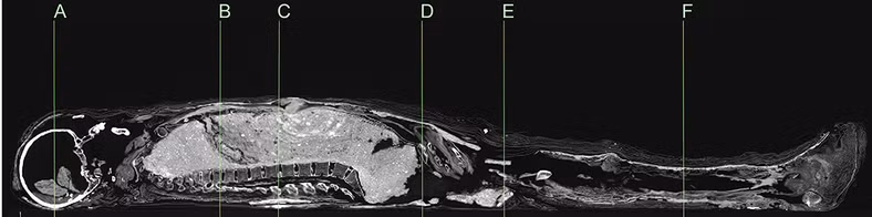 Gần đây, nhà khảo cổ Karin Sowada (Đại học Macquarie, Australia) dẫn đầu một nhóm chuyên gia có phát hiện lớn. Nhóm của ông phát hiện xác ướp được bọc bằng bùn trông như chiếc kén. Đây là điều rất hiếm gặp.