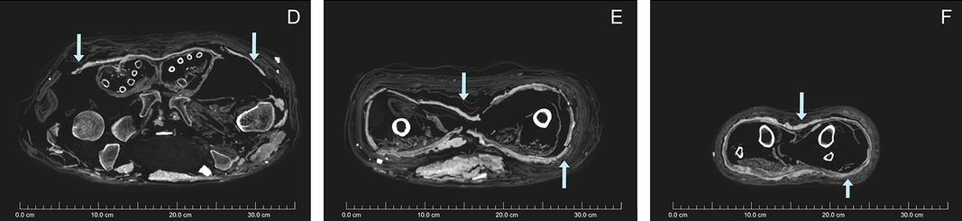 Lý giải về việc người Ai Cập bọc thi thể bằng bùn thay vì nhựa cây, nhà khảo cổ Sowada cho hay bùn là vật liệu có giá thành rẻ hơn nhiều.