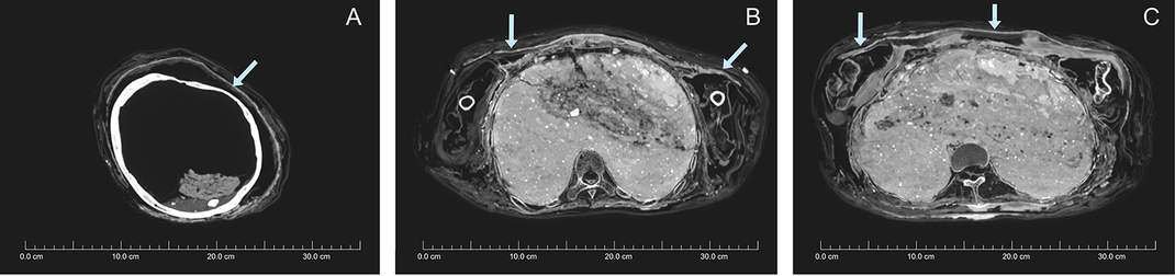 Các nhà nghiên cứu lý giải có thể các thương gia đã đặt xác ướp vào cỗ quan tài không liên quan để bán được giá cao hơn.