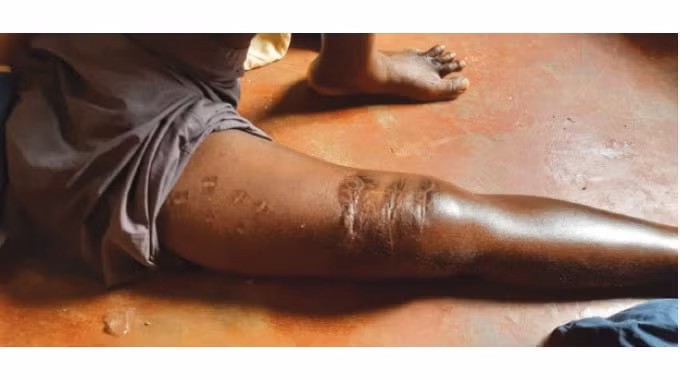 Người đàn ông chiến đấu tay không cùng lúc 3 con cá sấu hung tợn - Hình 2 Nguoi dan ong chien dau tay khong cung luc 3 con ca sau hung ton-Hinh-2