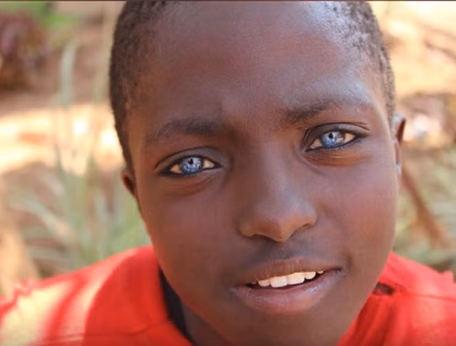 Adrian là đứa trẻ sở hữu đôi mắt ánh sáng xanh. Nhiều người cho rằng đứa trẻ đeo kính áp tròng, song sự thật là đôi mắt tự nhiên mà trời đã ban cho đứa trẻ