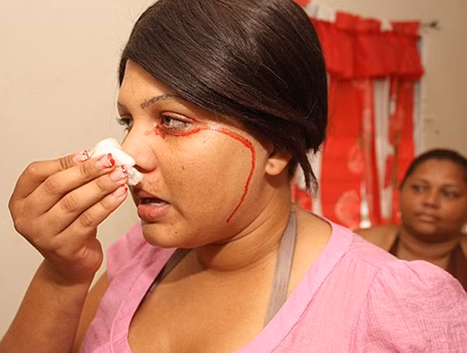 Cô Delfina Cedeno ở Dominica mắc một chứng bệnh rối loạn nghiêm trọng. Cứ mỗi lần khóc là máu lại chảy ra từ mắt, đầu ngón tay và rốn của cô