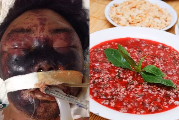 Nhiều dịch bệnh nguy hiểm có nguy cơ bùng phát cận Tết - Hình 2 Nhieu dich benh nguy hiem co nguy co bung phat can Tet-Hinh-2