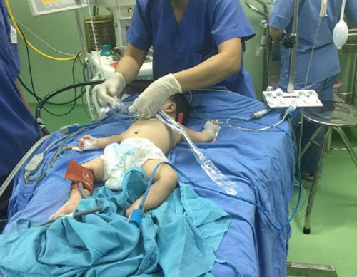 Be trai bien thanh gai vi co 2 bo phan sinh duc