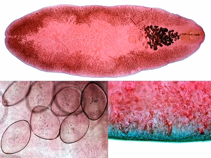 Khi vào cơ thể người, trứng sán Fasciolopsis buski nở và phát triển, gây ra những cơn đau bụng nhẹ và triệu chứng tiêu chảy, dị ứng hoặc còn gây ra các bệnh mạn tính ở túi mật, vỡ gan, xơ gan, suy gan...