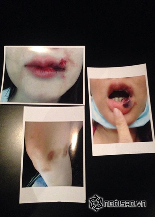 Cụ thể, tháng 9/2015, Dương Yến Ngọc tung bằng chứng bị chồng cũ đánh đập, hăm dọa sau khi ly hôn. Ngoài ra, cô còn quyết định kiện chồng cũ và giành lại con trai tại tòa.