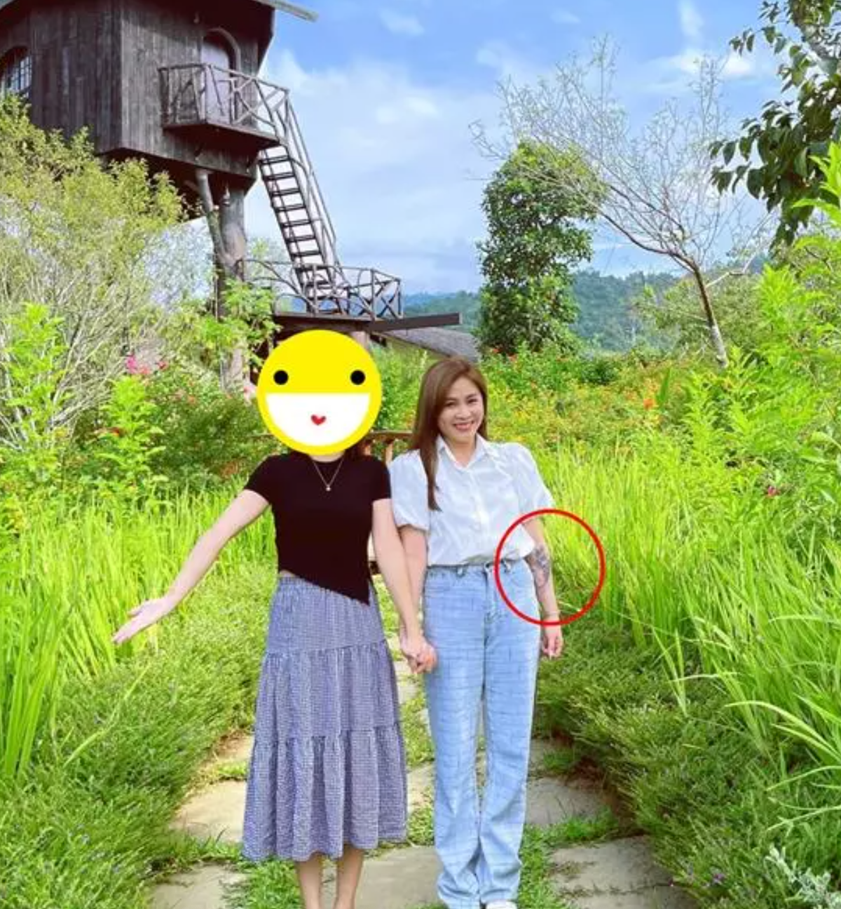 Cư dân mạng tỏ ra khá khó hiểu, tò mò về sự có mặt của "vết loang lổ" trên cánh tay cựu MC Chúng Tôi Là Chiến Sĩ.