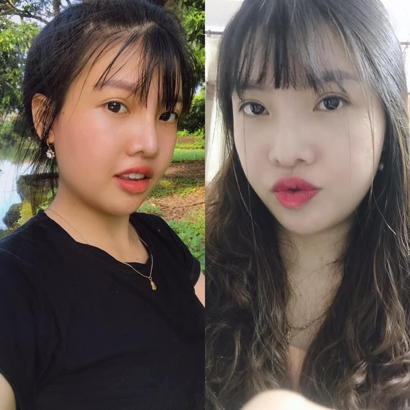 Sau cuộc hôn nhân không mấy hạnh phúc, Quách Phượng đã quyết định trùng tu, "đập đi xây lại" toàn bộ gương mặt.