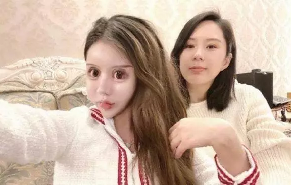 Tiểu Z Na Na là một người mẫu kiêm ca sĩ "mặt rắn" từng gây xôn xao mạng xã hội khi có sở thích nghiện phẫu thuật thẩm mỹ từ năm 13 tuổi.