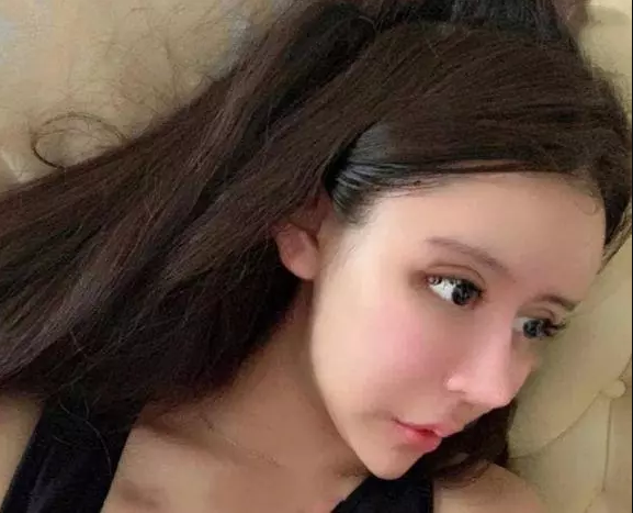 Tuy nhiên sau 3 năm với hơn 60 cuộc phẫu thuật, khuôn mặt và thân hình của Nana đã thay đổi hoàn toàn. Nếu chỉ nhìn những bức ảnh ghép giữa quá khứ và hiện tại, không ai tin nổi đây là cùng một người.