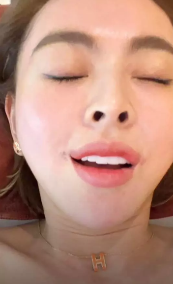 Theo tiết lộ chi phí cho lần "can thiệp" mặt lần này của "hot girl bán hàng online" hết 10 triệu đồng. Cô cho biết mình cũng là người trải nghiệm dịch vụ này đầu tiên tại spa.