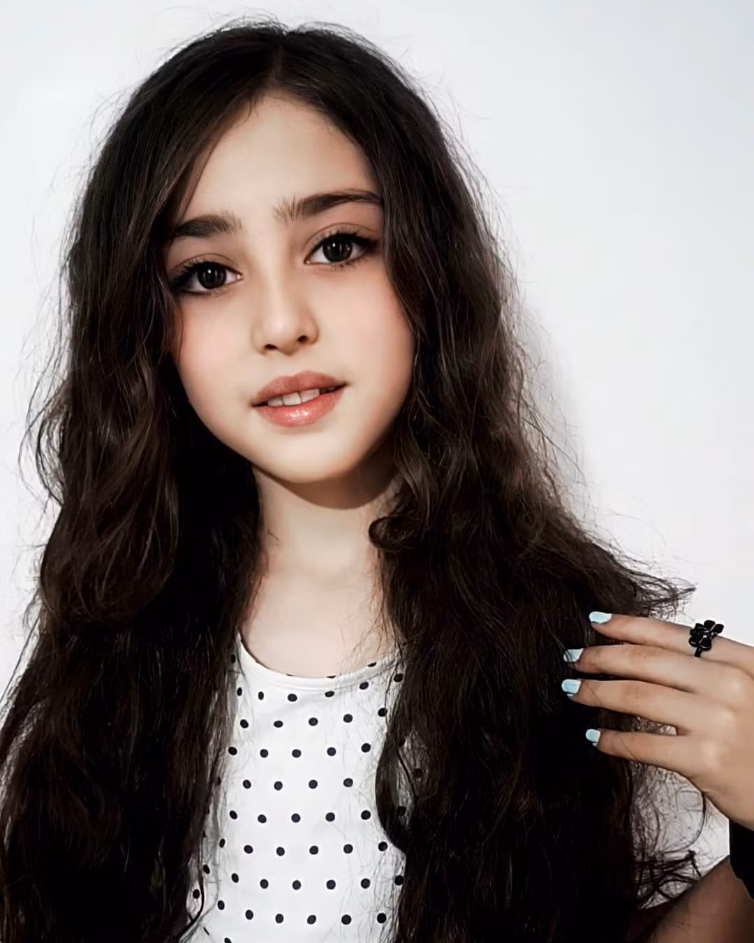 Hiện tại, Mahdis Mohammadi đã là một cô bé 10 tuổi. Đường nét trên gương mặt của cô cũng có nhiều thay đổi.