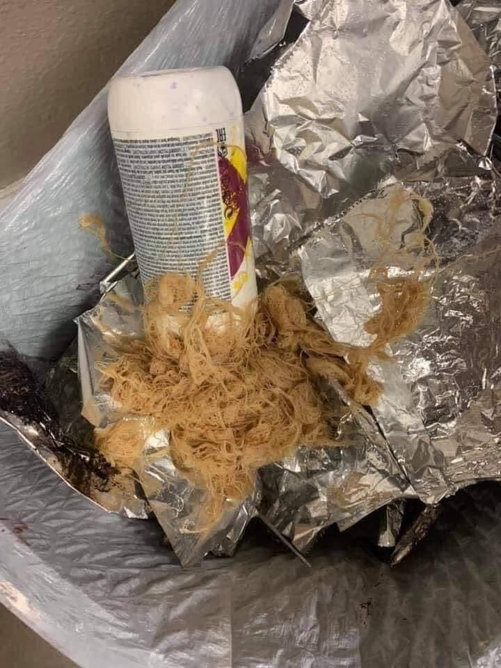 Mái tóc của cô gái buộc phải cắt đi khiến ai nấy đều tiếc nuối. Trông mớ tóc hỏng chẳng khác nào mì tôm nẫu quá lửa phải bỏ vào sọt rác.