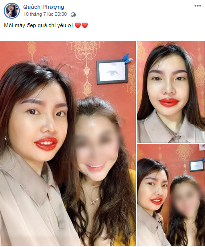 Tuy nhiên "Phượng Thị Nở" tiếp tục công cuộc chỉnh sửa lại gương mặt khi mới đây có những can thiệp tiểu phẫu vào môi và lông mày.