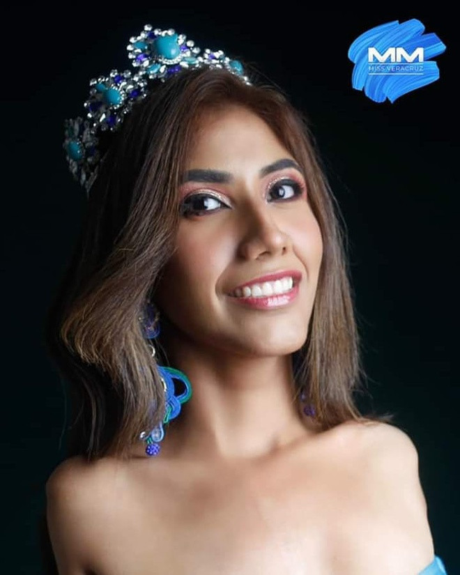 Trên trang cá nhân, Gabriela Molina thường chia sẻ nhiều hình ành của bản thân tham gia các hoạt động cộng đồng. Dù thiếu đi đôi tay, cô gái sở hữu gương mặt xinh đẹp và vóc dáng cao ráo, thân hình săn chắc.