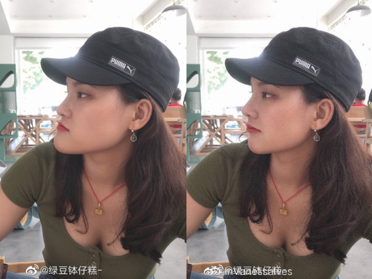 Có những ca chỉnh sửa "vi diệu" đến nỗi khiến người ta không thể không ngưỡng mộ.