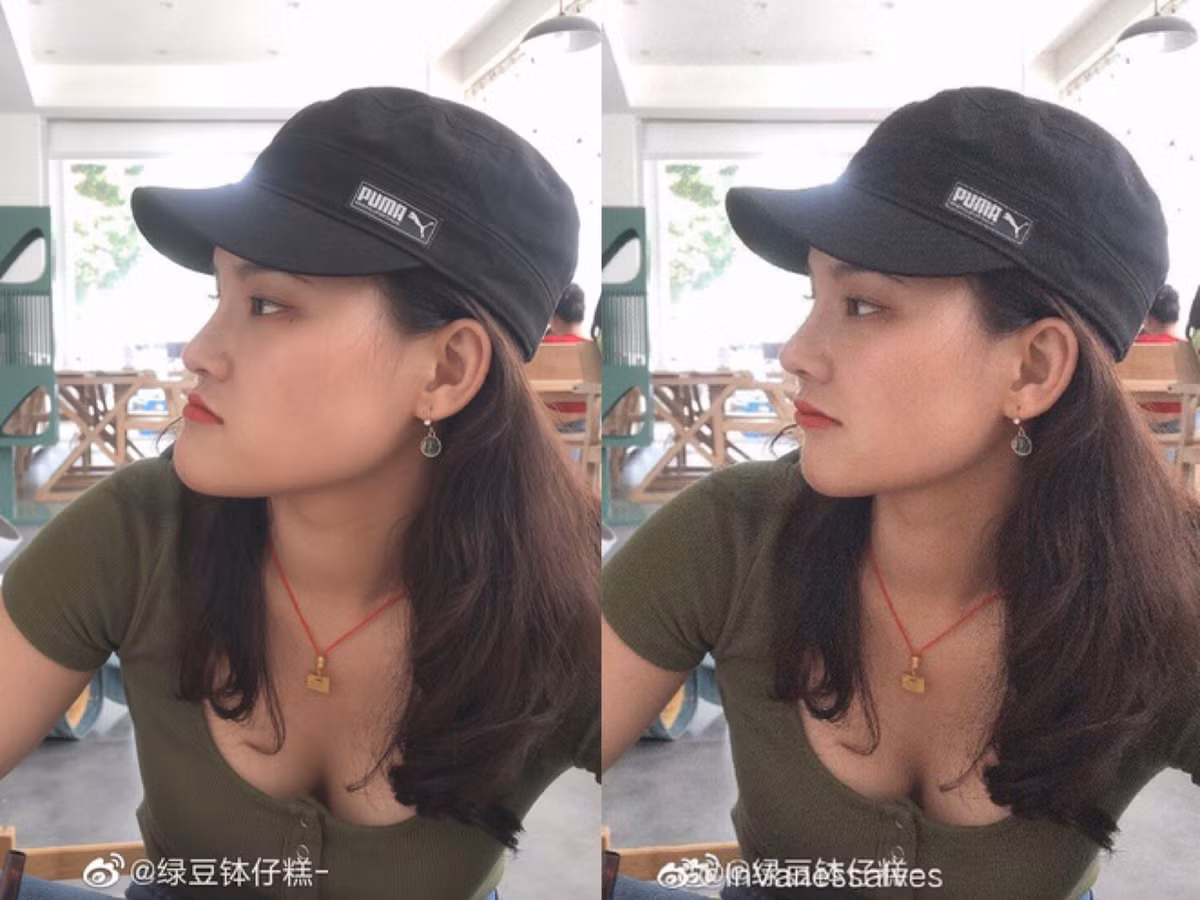 Có những ca chỉnh sửa "vi diệu" đến nỗi khiến người ta không thể không ngưỡng mộ.