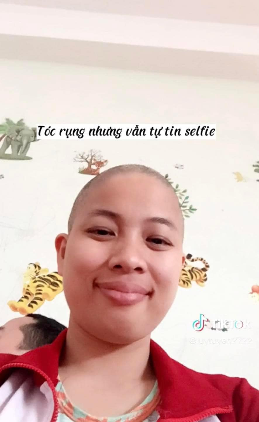 Phải cạo trọc đi mái tóc dài, tuy nhiên tinh thần chị vẫn lạc quan.