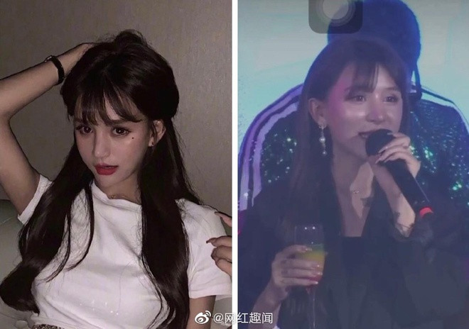 Như cô nàng Vương Đậu Đậu lộ khuôn mặt cứng đờ, kém tự nhiên vì phẫu thuật thẩm mỹ ngay trên sân khấu.