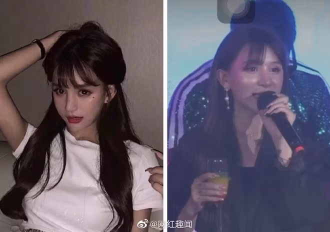 Như cô nàng Vương Đậu Đậu lộ khuôn mặt cứng đờ, kém tự nhiên vì phẫu thuật thẩm mỹ ngay trên sân khấu.