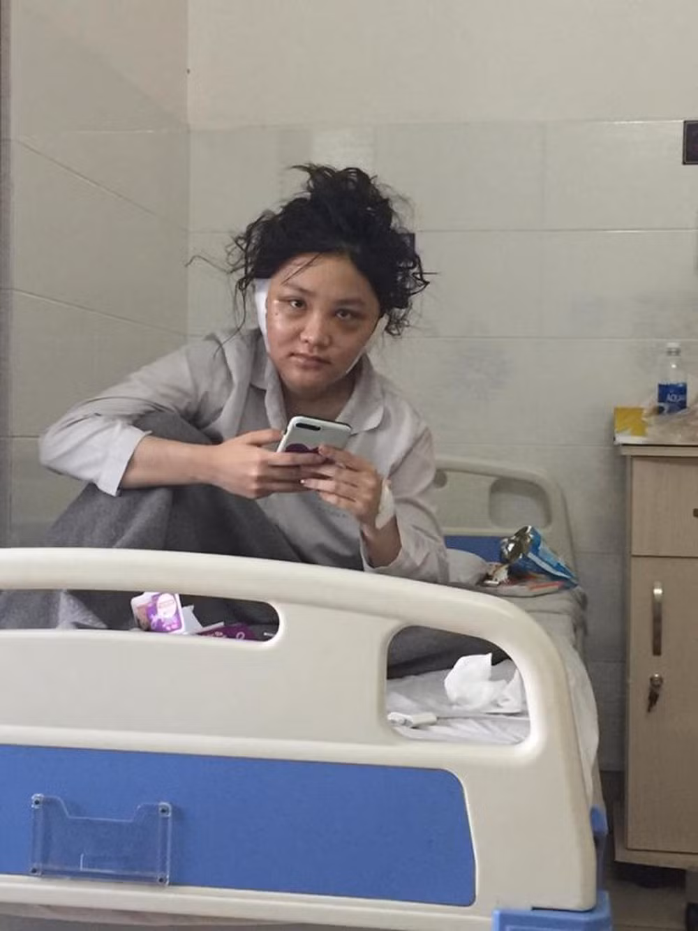 Sau scandal năm 2018, Kiều Anh bất ngờ lộ ảnh đi "đập đi xây lại" nhan sắc. Những hình ảnh của cô nàng trong bệnh viện khiến không ai có thể nhận ra hot girl ngày nào.