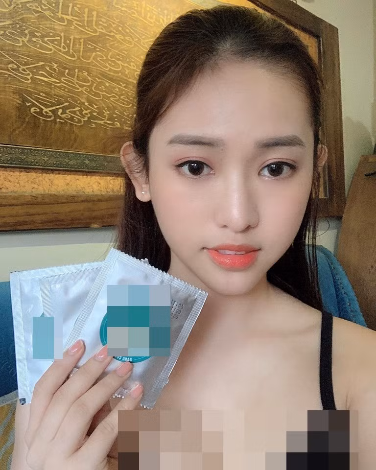 CĐM đặt nghi vấn phần trán và cằm của Thúy Vi được tiêm filler hoặc trang điểm quá dày.