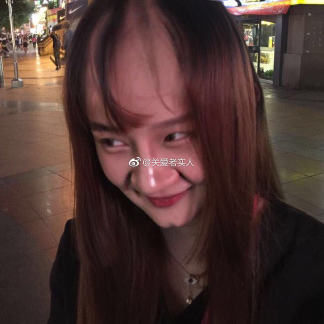 Mắt cô nàng bé hơn rất nhiều, còn sưng húp, chiếc mũi cao thẳng đâu không thấy chỉ có một chiếc mũi to bè cực thô. Hành động cử chỉ của cô gái cũng rất thiếu nữ tính khiến chàng trai khó lòng chấp nhận việc có nên hẹn hò tiếp anh không.