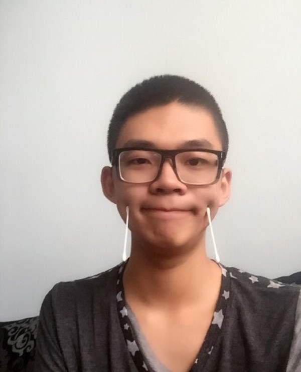 Trào lưu khoe má lúm đồng tiền bằng cách kẹp đồ vật nhẹ như bút, bông tai,...và phần lúm rồi giữ nguyên trong một thời gian nhất định. Càng giữ được lâu càng chứng tỏ má lúm sâu, đẹp.