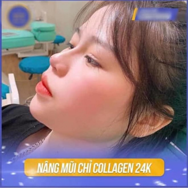 Về phía Huỳnh Anh, cô không lên tiếng mà lặng lẽ block những người đặt câu hỏi nghi vấn về hình ảnh này.