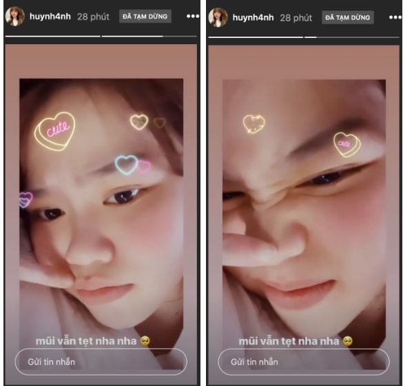 Trên Instagram, Huỳnh Anh cũng quay clip lại để chứng minh mình không hề "dao kéo". Đặc biệt, cô còn dùng tay ấn mạnh vào mũi và khẳng định "mũi vẫn tẹt nha".