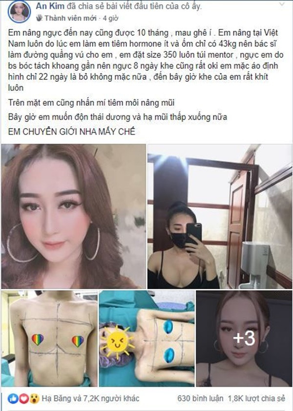 Mới đây, một bài viết chia sẻ kinh nghiệm phẫu thuật thẩm mỹ thu hút sự quan tâm đặc biệt của cộng đồng mạng. Đặc biệt hơn, người có những chia sẻ này là một cô gái đã phẫu thuật chuyển giới.