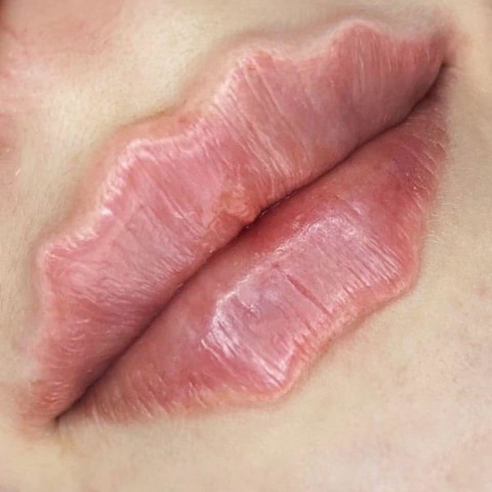 Không biết tên gọi chính xác của loại môi này là gì nhưng vì có những đường uốn lượn như chiếc răng cưa nên cộng đồng mạng tạm gọi đây là trào lưu môi răng cưa.