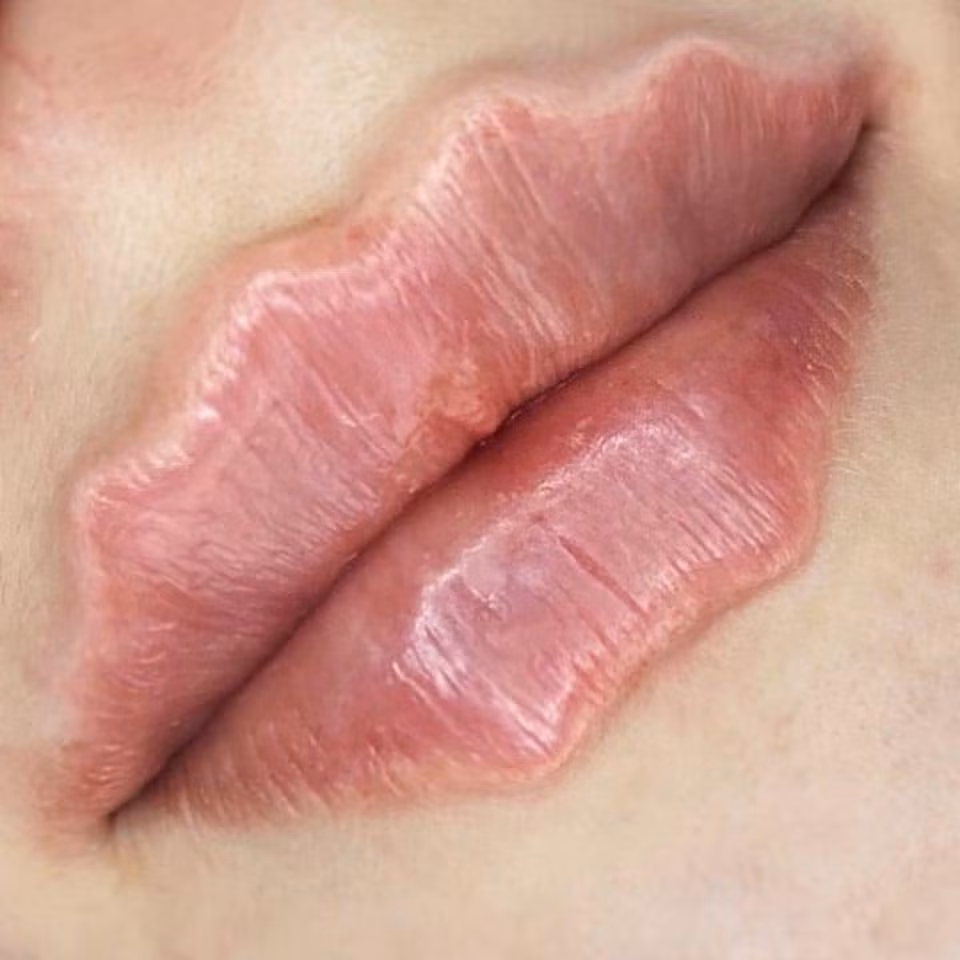 Không biết tên gọi chính xác của loại môi này là gì nhưng vì có những đường uốn lượn như chiếc răng cưa nên cộng đồng mạng tạm gọi đây là trào lưu môi răng cưa.