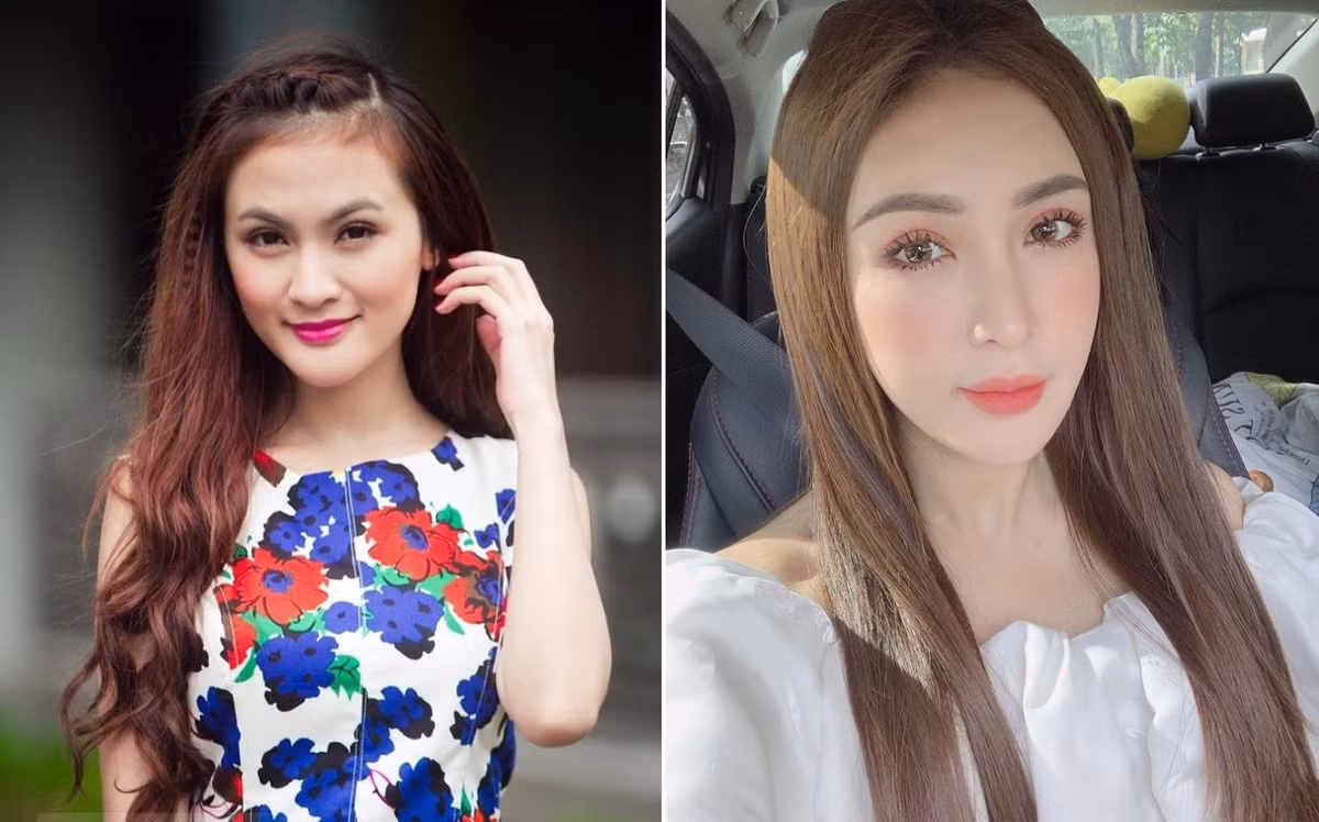 Hiện tại, Kelly đã tạm dừng dao kéo. Cô cho biết hài lòng với vẻ ngoài của mình và thường xuyên lên tiếng ủng hộ những người có nhu cầu làm đẹp bằng cách phẫu thuật, nhất là những người cần cải thiện nhan sắc.