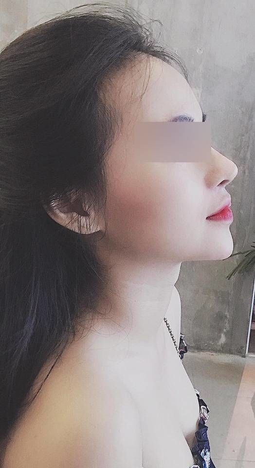 Cô nàng còn khẳng định, sau khi nâng mũi thì cuộc sống ổn định và công việc thăng tiến hơn rất nhiều. Khá ưng với dáng mũi hiện tại.