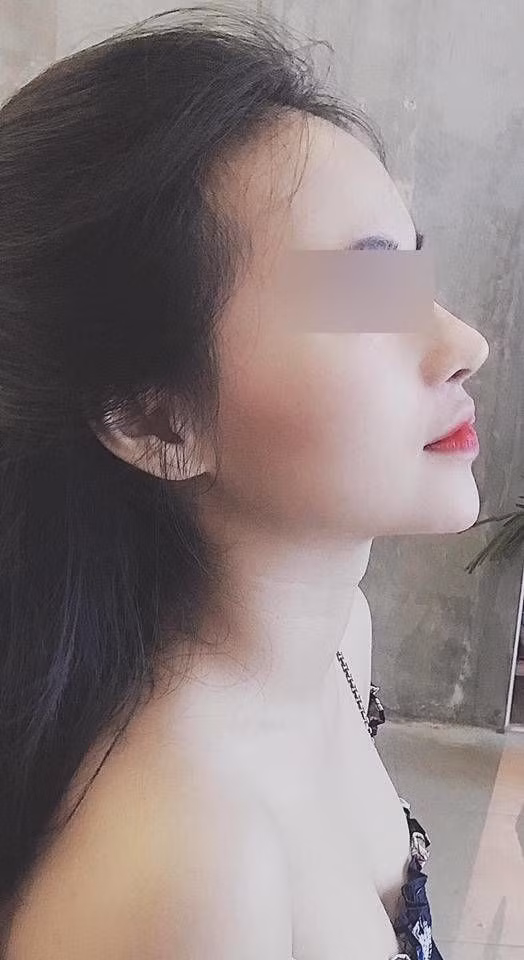 Cô nàng còn khẳng định, sau khi nâng mũi thì cuộc sống ổn định và công việc thăng tiến hơn rất nhiều. Khá ưng với dáng mũi hiện tại.