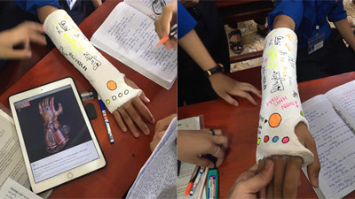 Thậm chí bạn bị gãy tay lại trở thành trò đùa, thứ tiêu khiển cho cả hội bạn thân khi tha hồ sáng tạo, vẽ với vào cánh tay băng bó của bạn.