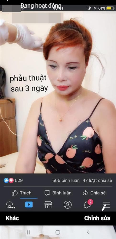 Theo nhiều bình luận của dân mạng, không thể phủ nhận việc căng da mặt, nhan sắc của cô dâu Thu Sao trẻ hơn trước rất nhiều.