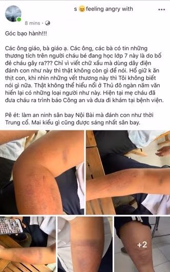 Dan mang buc xuc voi ong bo danh con nhu ke thu vi 