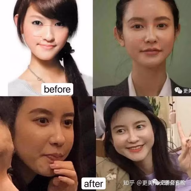 Tuy nhiên, gần đây trên mạng xã hội xuất hiện những bức ảnh được cho là của Trương Đại Dịch khi chưa can thiệp thẩm mỹ. "Bồ nhí" chủ tịch Taobao trong hình không phải quá xấu xí nhưng chẳng mấy nổi bật, các nét trên khuôn mặt kém hài hòa.