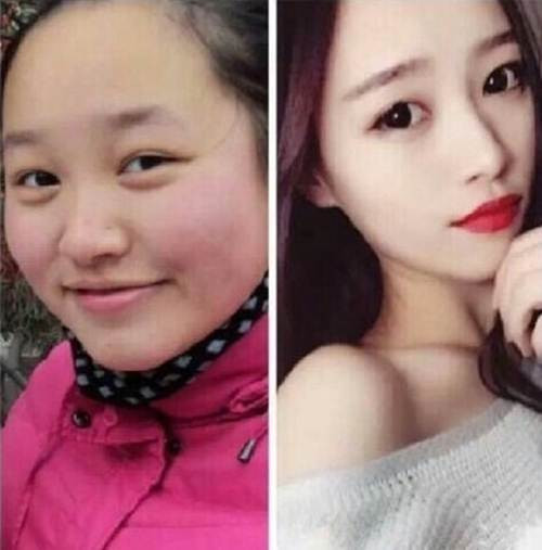 Nghĩ là làm, bắt đầu từ hôm đó, Tống Tư Nguyên nhịn ăn, uống tảo xoắn giảm cân. Để duy trì dinh dưỡng, tránh bị ngất xỉu, Tư Nguyên dùng vitamin, uống sinh tố.