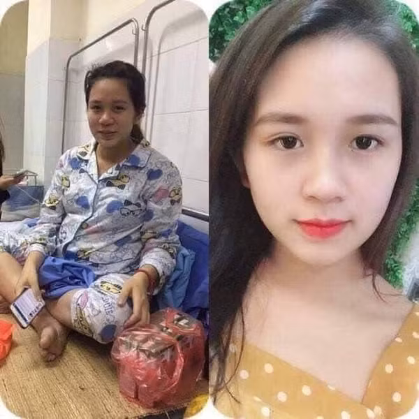 Hot girl khi mang bầu cũng chịu chung "lời nguyền" xấu xí mà thôi.