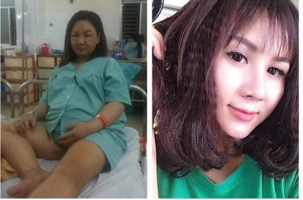 Trong thời gian mang bầu không tránh khỏi tăng cân, chân tay to hơn, khuôn mặt cũng sưng lên trông cực kỳ khó nhịn. Vậy mà 9 tháng mang bầu bà mẹ nào cũng hạnh phúc mong con, chứ chả mấy ai quan tâm đến nhan sắc.