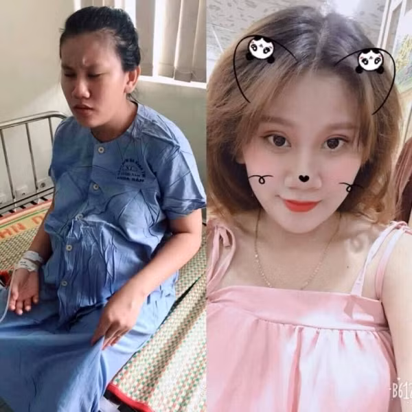 Cùng với những xấu xí về ngoại hình, mỗi bà mẹ còn phải bước qua "quỷ môn quan" mới có thể đón em bé chào đời. Có câu ví "đau như đau đẻ" là đủ hiểu cơn đau này dữ dội đến thế nào.