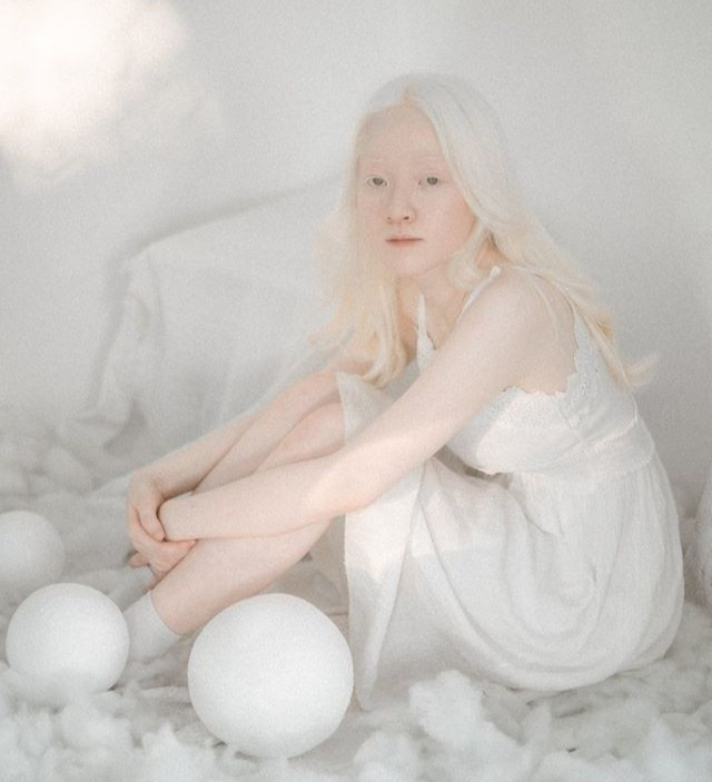 Thần thái và có nét cuốn hút rất riêng là những lời khen ngợi của nhiều người dành cho nữ sinh bạch tạng Ngô Thúy Quỳnh (sinh năm 1998). Loạt ảnh mới đây của 9X được chia sẻ trên một số diễn đàn nhiếp ảnh, hút hơn 10.000 lượt tương tác cùng hàng nghìn bình luận từ dân mạng.